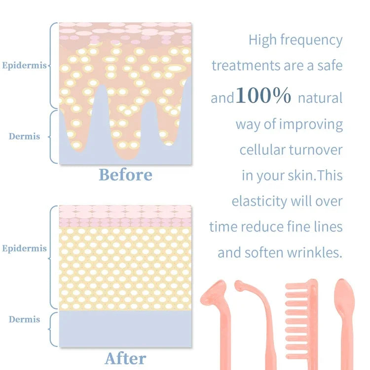 Portable High Frequency Skin Therapy Wand Kit
